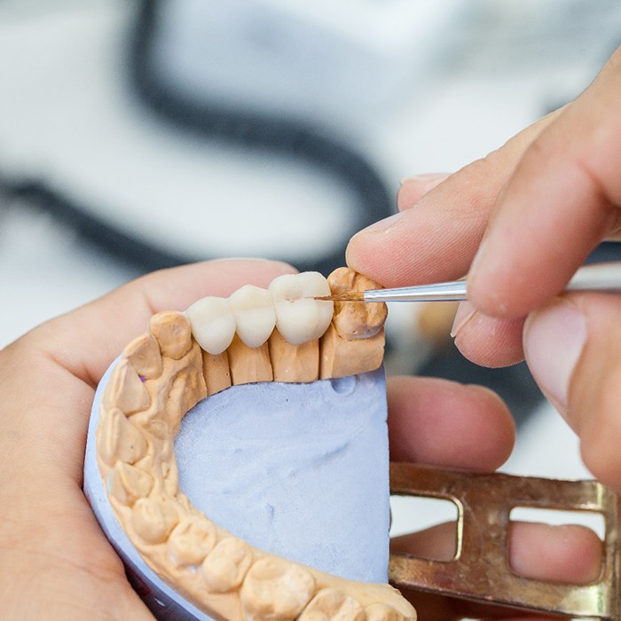 A dental technician working on a dental bridge