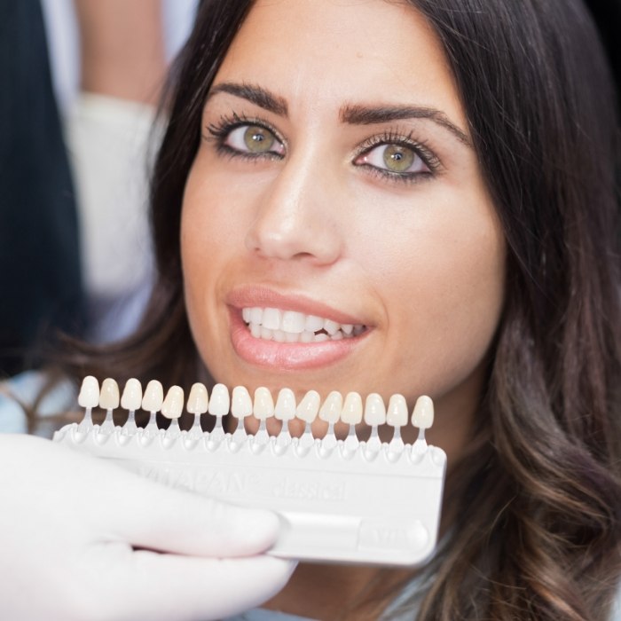 Woman trying on dental veneers while visiting cosmetic dentist in Arlington