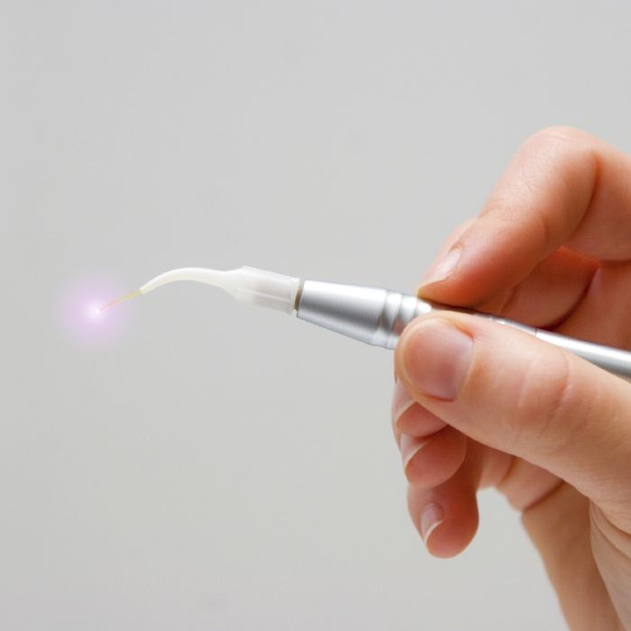 Dentist holding a soft tissue laser