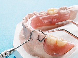 closeup of partial denture