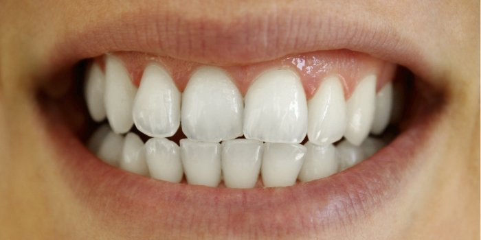 Close up of white teeth after treatment from Arlington dentist