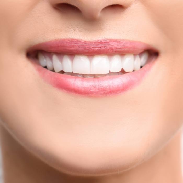 Close up of mouth with straight white teeth